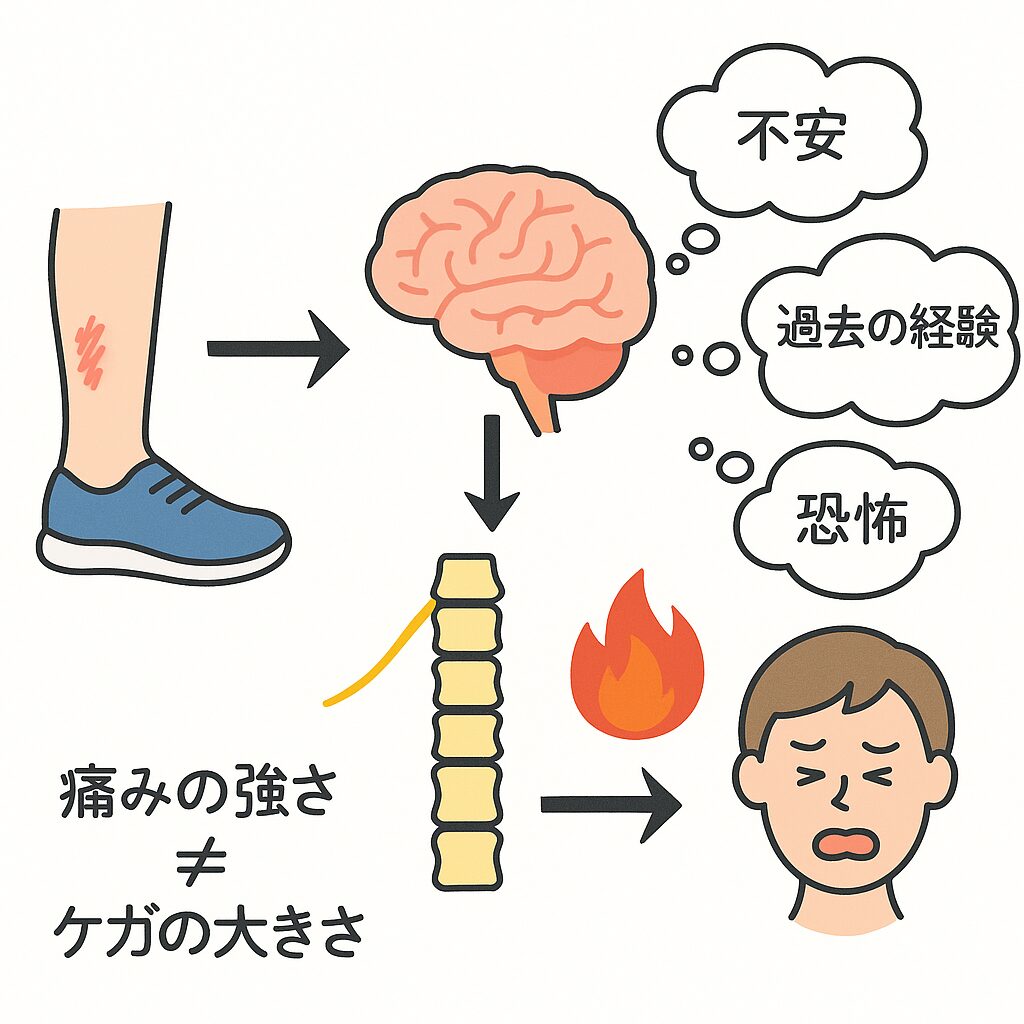 怪我 → 神経 → 脳 → 感情で痛みが増幅する流れの図